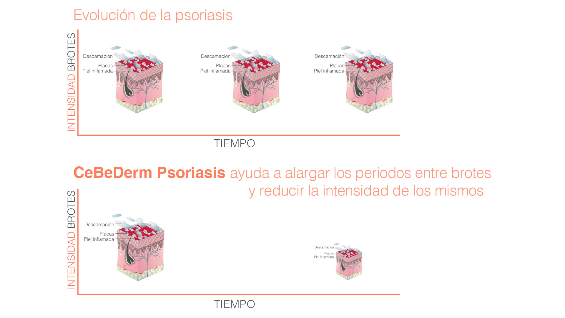 Alarga los periodos entre brotes de psoriasis y reduce la intensidad de los mismos